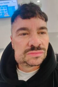 Shiky es hospitalizado de emergencia por segunda ocasión para una cirugía