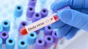 Confirman primer caso de ébola sin vacuna en Estados Unidos
